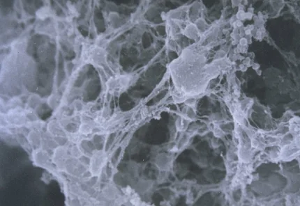 Figure: Yeast cells electrostatically entrapped in isinglass collagen